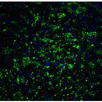 IHC-plus™ Polyclonal Rabbit anti-Human CDH13 / Cadherin 13 Antibody (IHC, IF, WB)