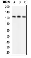 GRIA1 / GLUR1 Antibody (phospho-Ser849)
