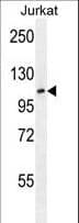 JHDM1A / KDM2A Antibody (aa500-527)