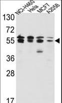 IMPDH2 Antibody (aa180-210)
