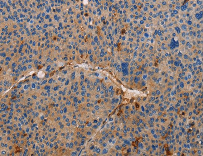 Polyclonal Rabbit anti-Human AMBRA1 Antibody (IHC)