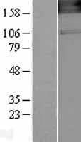 NOS1 / nNOS Protein (Over-Expression Lysate Myc-DDK (Flag))