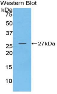 FGFR3 Antibody (aa166-375)