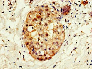 CREBBP / CREB Binding Protein Antibody