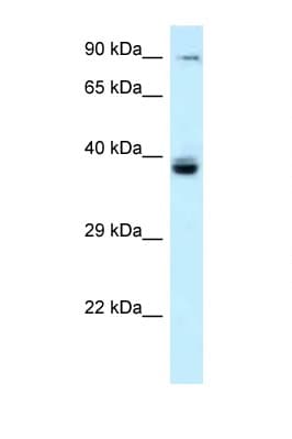 TAGAP Antibody (aa202-251)