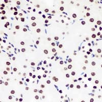 Polyclonal Rabbit anti-Human DDX21 Antibody (IHC, IF, WB)