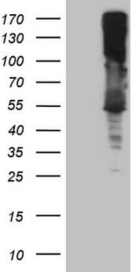 ASS1 / ASS Antibody (C-Terminus, clone OTI8C4, Carrier-free)