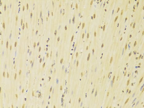 Polyclonal Rabbit anti-Human HNRNPK / hnRNP K Antibody (IHC, IF, WB)