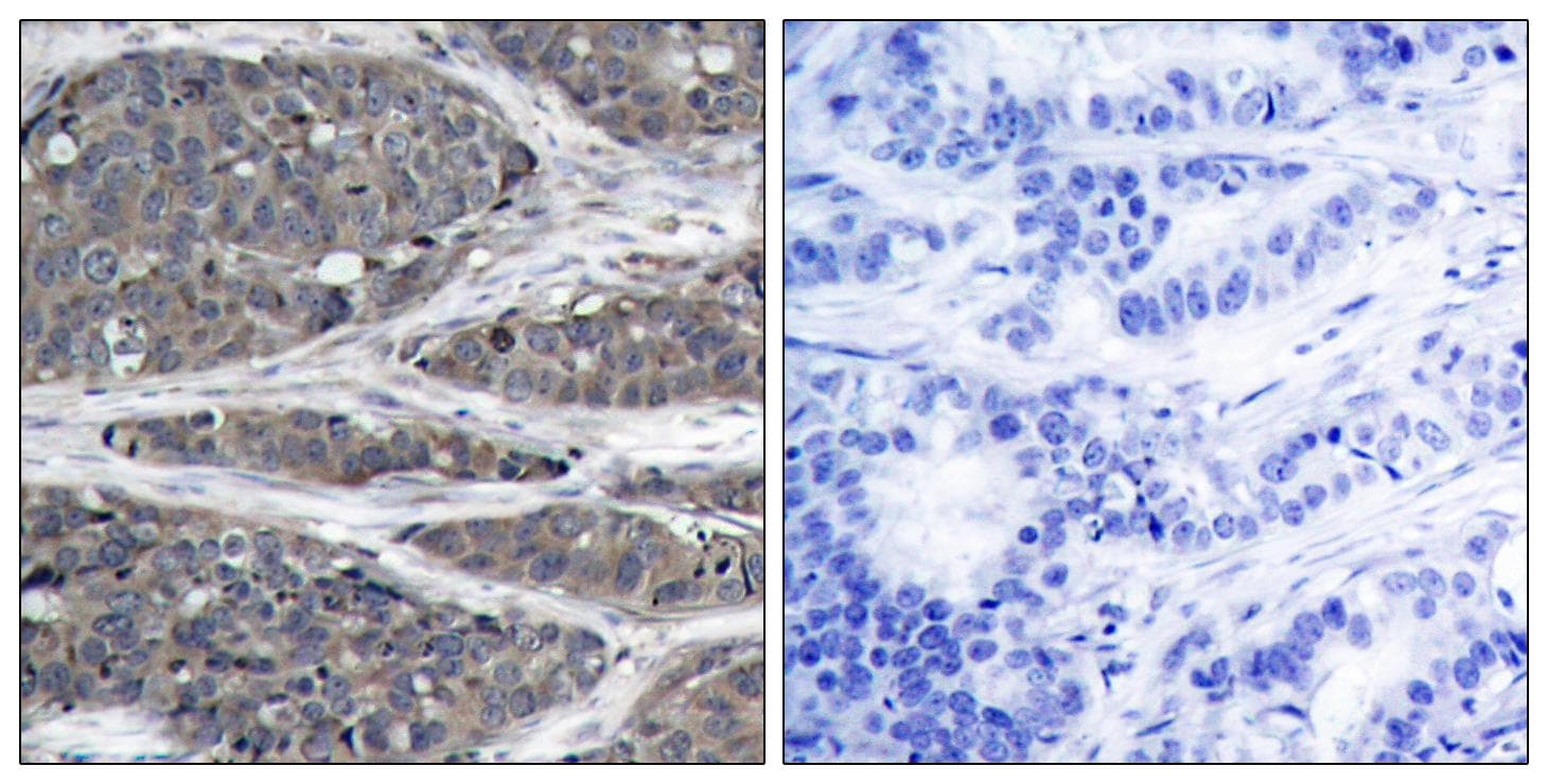 Polyclonal Rabbit anti-Human NFKB1 / NF-Kappa-B Antibody (p932, IHC, WB)