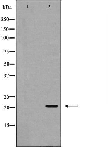 EPO / Erythropoietin Antibody