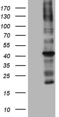Monoclonal Mouse anti-Human MTOR Antibody (clone OTI4A6, aa1766-2144, IHC, WB)