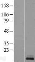 KISS1 / Kisspeptin / Metastin Protein (Over-Expression Lysate Myc-DDK (Flag))