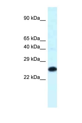 HOXB9 Antibody (C-Terminus)