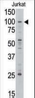 MLLT10 Antibody (aa998-1027)