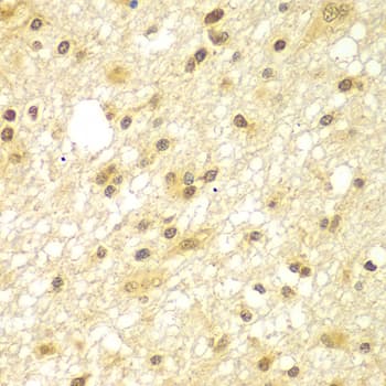 TBL1XR1 / TBLR1 Antibody