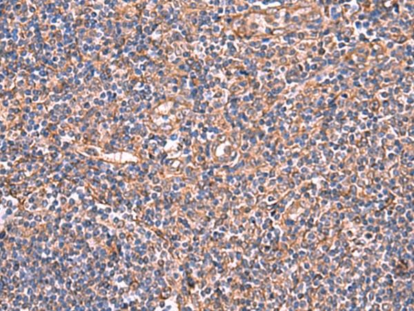 TTC38 Antibody