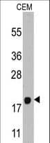 Polyclonal Rabbit anti-Human CXCL7 / PPBP Antibody (aa97-128, IHC, WB)