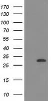 CTDSP1 / SCP1 Antibody (clone OTI1B6)