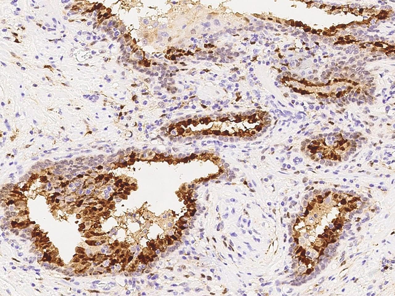 Polyclonal Rabbit anti-Human Latexin / MUM Antibody (Preservative Free, IHC, WB)
