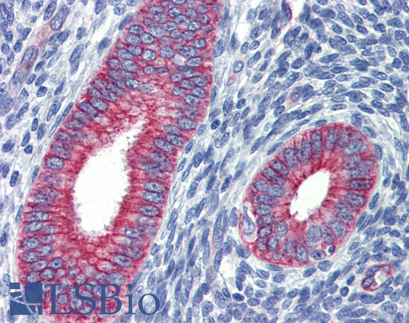 Polyclonal Rabbit anti-Human ZNF71 Antibody (C-Terminus, IHC, WB)