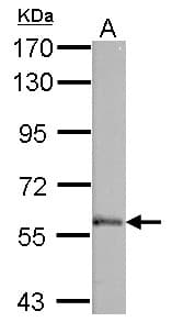 Polyclonal Rabbit anti-Human PALS2 / MPP6 Antibody (aa1-44, IHC, WB)