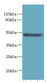 HTTY1 / TTYH1 Antibody