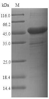 Human CD66c / CEACAM6 Protein (Recombinant 6His-SUMO, N-terminus)