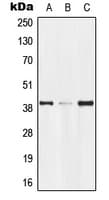 GPR174 Antibody (Internal)