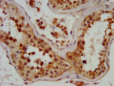 DMRTA3 / DMRT3 Antibody