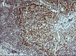 TP73 / p73 Antibody (clone OTI2H5)