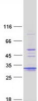 Human PSMA5 Protein (Recombinant Myc-DDK (Flag))