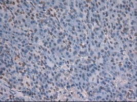 NOTCH1 Antibody (clone OTI4C9)