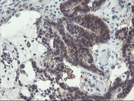 Monoclonal Mouse anti-Human DPH2 Antibody (clone OTI1A12, IHC, WB)