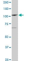 SALL4 Antibody (clone 6E3)
