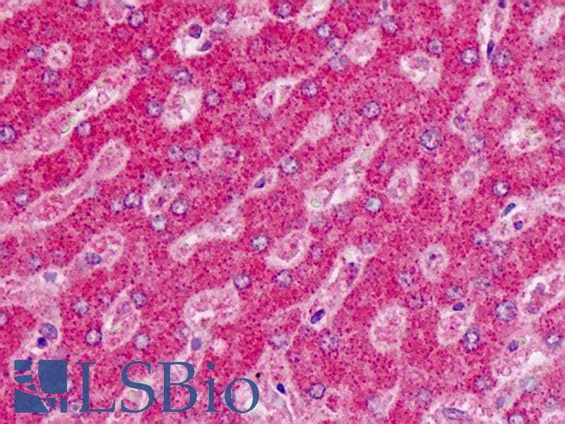 IHC-plus™ Polyclonal Rabbit anti-Human ALDH6A1 Antibody (aa30-59, IHC, WB)