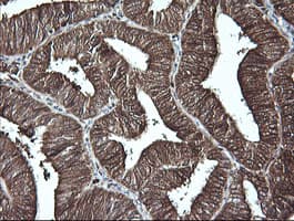 Monoclonal Mouse anti-Human LGALS3 / Galectin 3 Antibody (clone 1G8, Carrier-free, IHC, IF, WB)