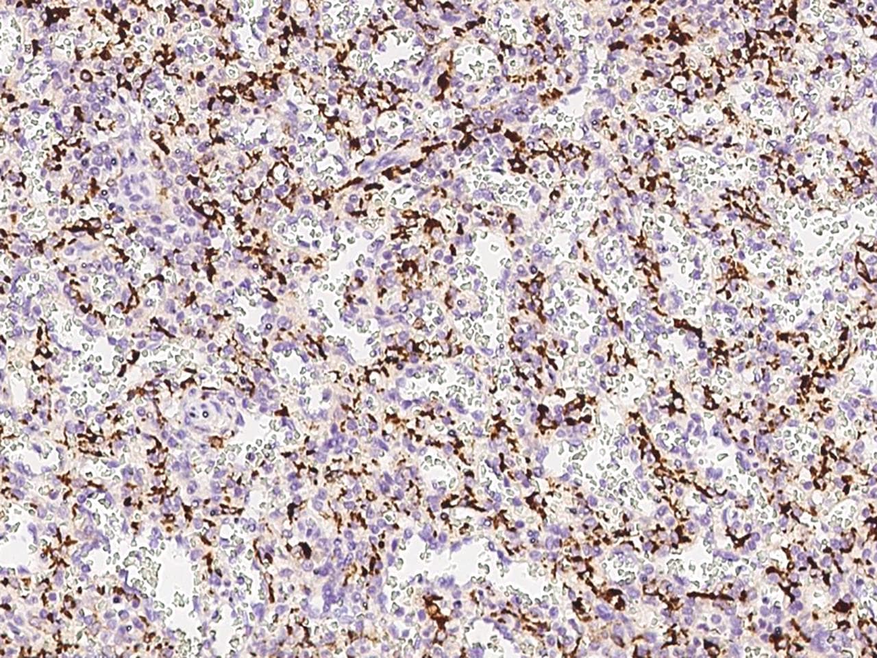 Monoclonal Mouse anti-Human CD68 Antibody (clone 11, Preservative Free, IHC)