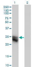 IHC-plus™ CTHRC1 Antibody (clone 1G12)