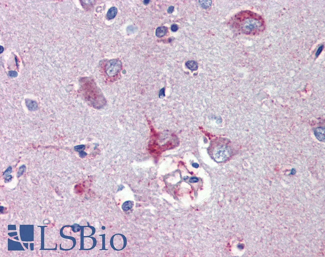 IHC-plus™ Polyclonal Goat anti-Human NODAL Antibody (aa242-253, IHC, WB)