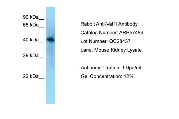 Polyclonal Rabbit anti-Mouse VAT1L Antibody (aa80-129, WB)