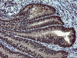 Mannose Phosphate Isomerase Antibody (clone OTI4G7)