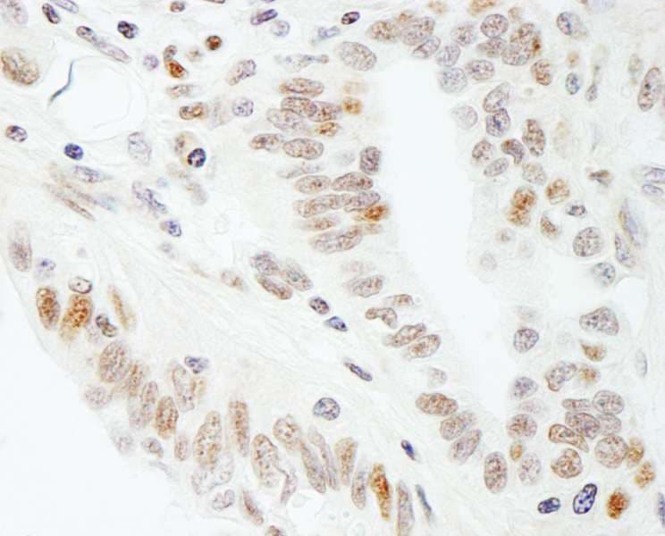 SPT5 / SUPT5H Antibody (aa1040-C-term)