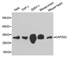 Polyclonal Rabbit anti-Human CAPZA2 / CAPZ Alpha 2 Antibody (IHC, WB)