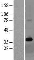 ZDHHC15 Protein (Over-Expression Lysate Myc-DDK (Flag))