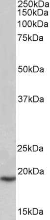 IHC-plus™ Polyclonal Goat anti-Human PLA2G2A / SPLA2 Antibody (IHC, WB)