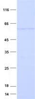 Human ZBTB32 / TZFP Protein (Recombinant His, N-Terminal)