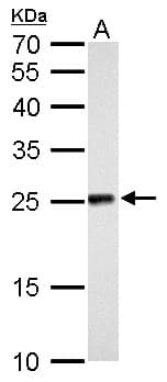 NDUFV2 Antibody (aa1-249)