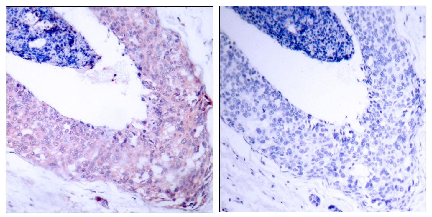 MYC / c-Myc Antibody (p58)