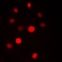 Polyclonal Rabbit anti-Human SF3B6 / SF3B14 Antibody (C-Terminus, IF, WB)