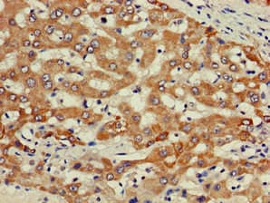 PIK3R2 / p85 Beta Antibody